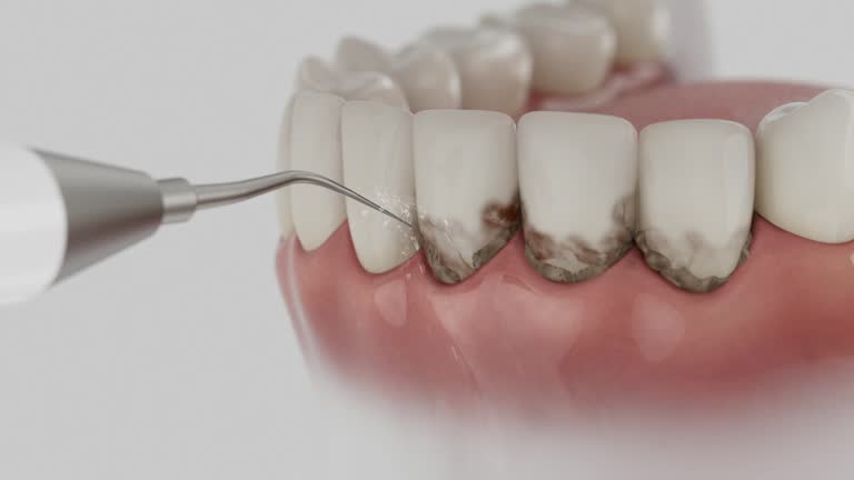 Trusted Root Canal Treatment service in San Juan Capistrano, CA - Dentist Open Now